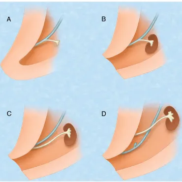 Figura 2. Dibujo esquemático del desarrollo las vesículas seminales. A: la yema ureteral (amarillo) surge del conducto de Wolff (azul) para dirigirse hacia el riñón embrionario (B)