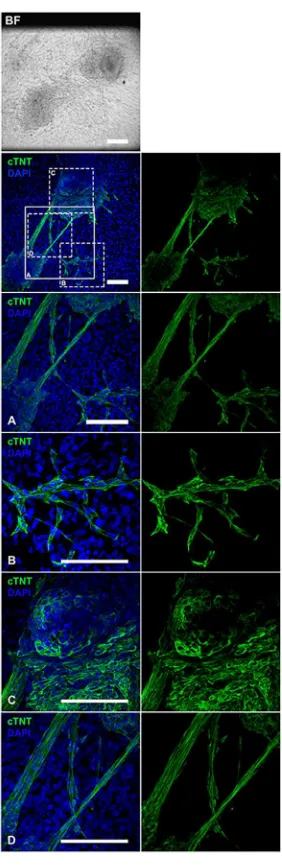 Figure 4.13:Bright field image and immunostaining for cTNT of beating areas from cardiac KiPS 3F.7 cell cultures at day 20 of differentiation with protocol 2