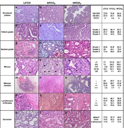 Fig. 1 Histopathological features and results of the morphologicalwhile carcinomas from HFCOanalysis of rat DMBA-induced mammary adenocarcinomas from thedifferent dietary groups, displayed as the percentage of tumours fromeach dietary group exhibiting the 