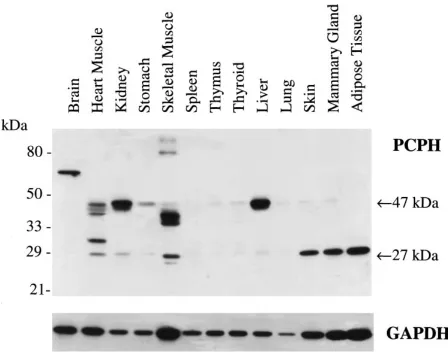 Figure 1. PCPH expression in normal organs of the virgin female Sprague-Dawley rat. Extracts prepared from the