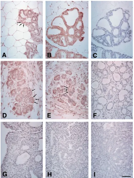 Figure 3. Immunohistochemical staining for PCPH in parafﬁn