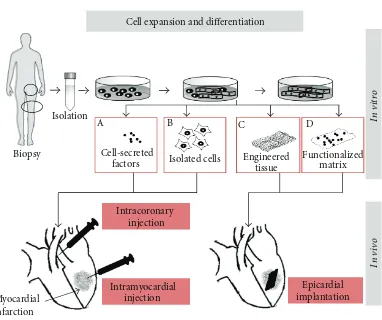 Figure 1: Cell therapy approaches for myocardial infarction: cells are isolated from biopsies, expanded, and eventually di ﬀerentiated in vitro