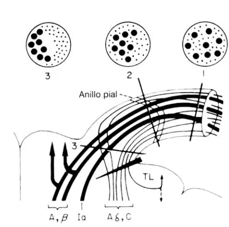 Figura 3.  Esquema de la zona de penetración de la raíz dorsal. En la porción periférica de la raíz zona de penetración (corte 3), las fibras C y A-finas están situadas en la superficie de la raicilla, predominantemente en la porción ventrolateral