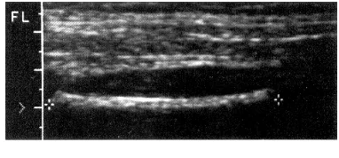 Fig. 6 Medición DBP                                                          Fig. 7 Medición CA 