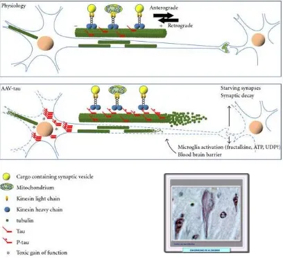 Figura 2. Modelo para la neurodegeneración mediada por Tau. En condiciones normales, la proteína Tau se regula bien a diferentes niveles: expresión de la isoforma, la fosforilación, unión al., 2010).de los microtúbulos en los axones y las dendritas