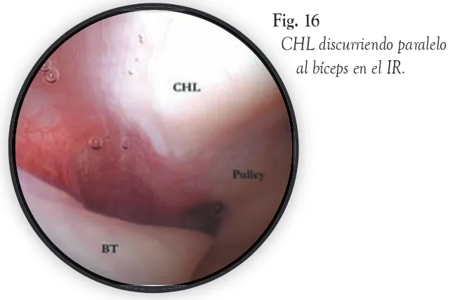 Fig. 16Fig. 16