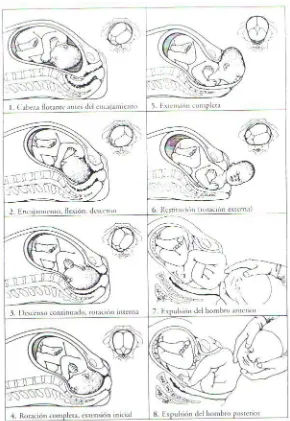 Fig. 2 Movimientos que realiza el feto en un parto eutócico. En el ángulo superior derecho aparecen las variaciones de la posición de la cabeza (1)