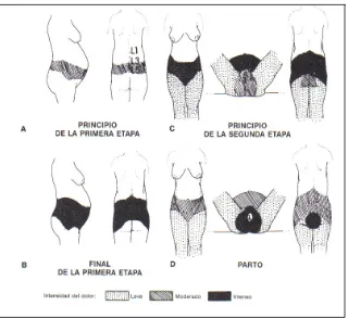 Fig 7. Intensidad y distribución del dolor propio del parto durante las diversas fases del trabajo del parto y parto (26)
