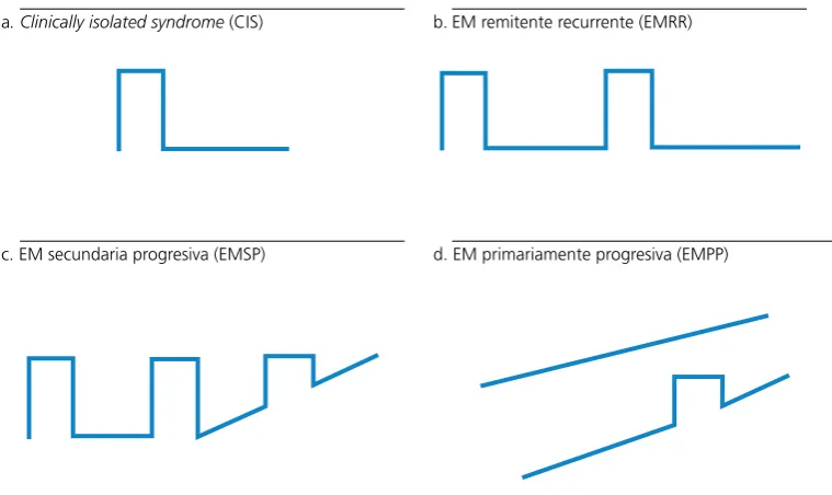 Figura 2. Formas clínicas de la Esclerosis Múltiple