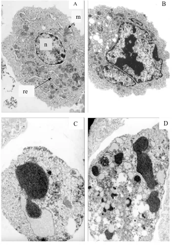 Fig. 1.4- Imatges de diferents morfologies cel·lulars d’hibridomes obtingudes per microscòpia electrònica de cèl·lula romanen intactes, C) Cèl·lula en una etapa avançada de l’apoptosi: condensació total del material genètic, fragmentació del nucli i la des