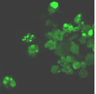 Fig. 1.5- Visualització per microscòpia confocal dels canvis morfològics soferts per la cèl·lula durant el procés d’apoptosi en un cultiu en discontinu de l’hibridoma KB26.5 en condicions de manca de glutamina