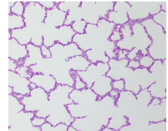 Figura 3. Anatomia patològica del grup control. Tinció hematoxilina-eosina en la que es mostren els espais alveolars i intersticials lliures