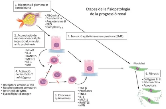 Figura 1: Mecanismes de progressió de dany renal 