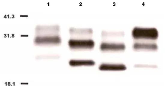 Fig. 1.10. Esquema dels tipus de MCJ descrits per Collinge i cols. en 