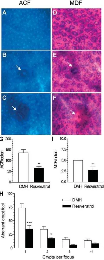 Table 1. Effect ofLesions in Colon Induced by DMH trans-Resveratrol in the Occurrence of Preneoplastica