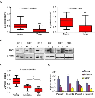 Figura 9. L’expressió d’RSK4 és més baixa en adenomes i carcinomes que en teixit normal 