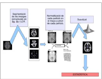 Figura 5.1: Esquema Aplicació protocol VBM per a SPM versió 5