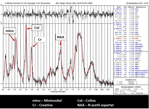 Figura 6. Gràfica resultat del post-processat de les dades de l’espectroscòpia: 