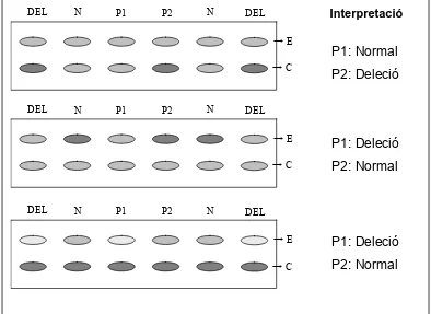 Figura 7. Exemples dels possibles patrons obtinguts en l’estudi de 