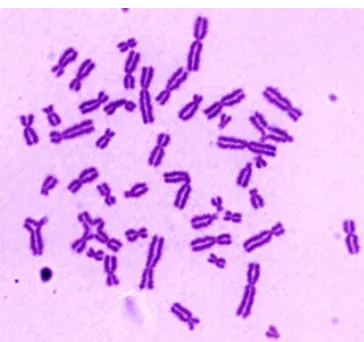Figura 9. Imatge representativa d’una metafase de limfòcits d’un pacient d’anèmia de Fanconi