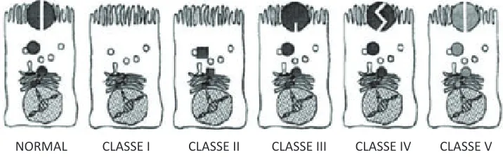 Figura 10.- Classes de mutacions a CFTR