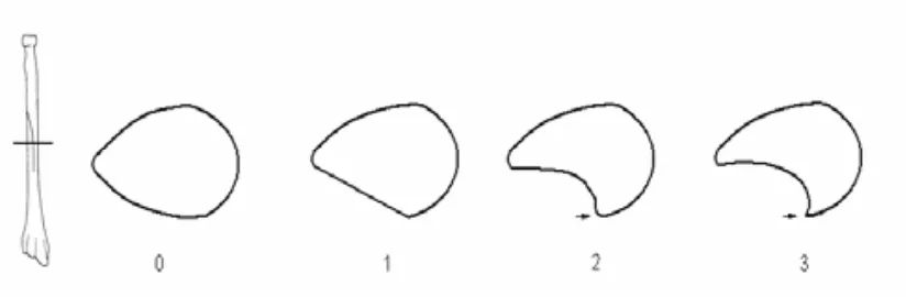 Figura 7. Graus de desenvolupament de l’entesi de l’abductor llarg del polze.  