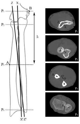 Figura 12. A l’esquerra: norma anterior de l’esquelet d’avantbraç dret en supinació. Es 