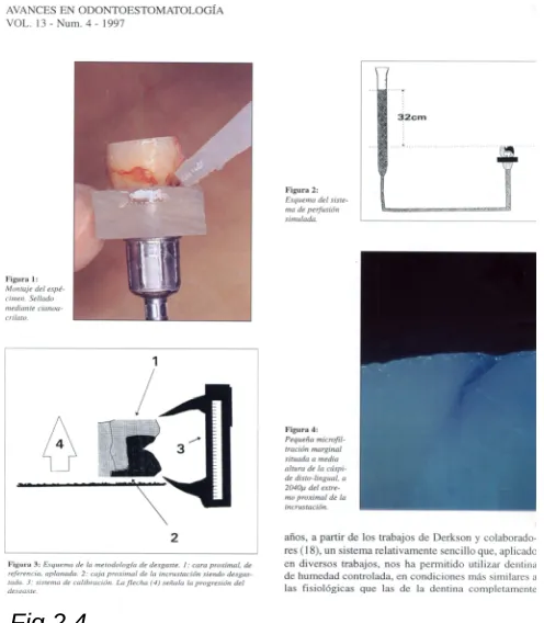 Fig.2.4 Cámara de filtración de Gómez y De la Macorra. 