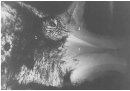 Figura   8.   Esquema   anatómico   de   la   irrigación   arterial   del   complejo   fibrocartílago   triangular   y   del   disco   articular