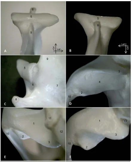 Fig. 2. Preparaciones óseas de la ATM. Vistas dorsal A, ventral B y lateral C del cóndilo de lamandíbula