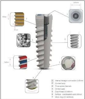 Fig 6. Características del implante Biocom®. Fuente: www.mis-implants.com 