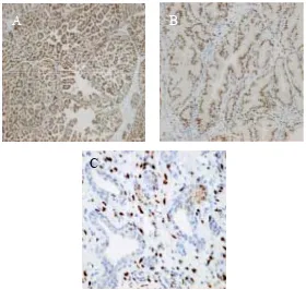 Figure 6. A) ERα immunohistochemistry in an M3 specimen taken from a dog with 