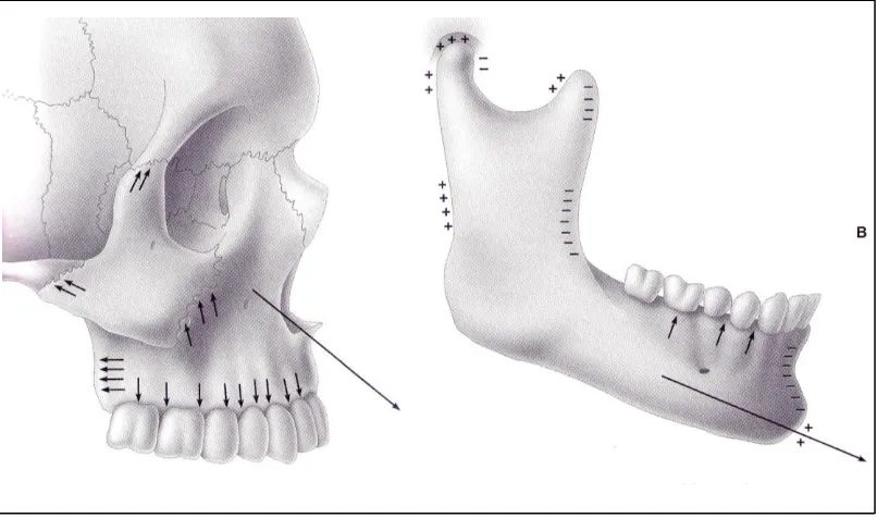 Figura 4: Diferentes aspectos del crecimiento del maxilar y la mandíbula 