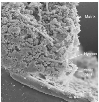 Figure I.4- Scanning electron micrograph of a cross section of a C. albicans biofilm. Different morphologies of C
