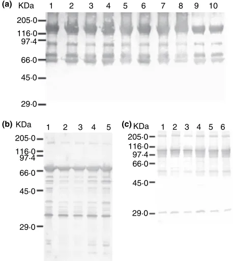 Figure 1 Distribution of the Bacillus thuringiensis isolates by their pro-tein proﬁles from bean and maize phylloplane and soil., kurstaki;, medellin; j, israelensis.