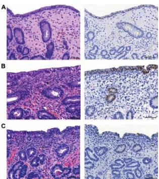 Fig. 3. Sections stained with hematoxylin and eosin, and cyclooxygenase-2 (COX-2) immunostaining, in jenny endometrial biopsies taken at oestrus (A), 6 hoursafter insemination with frozen semen but no ketoprofen treatment (B), and 6 hours after inseminatio