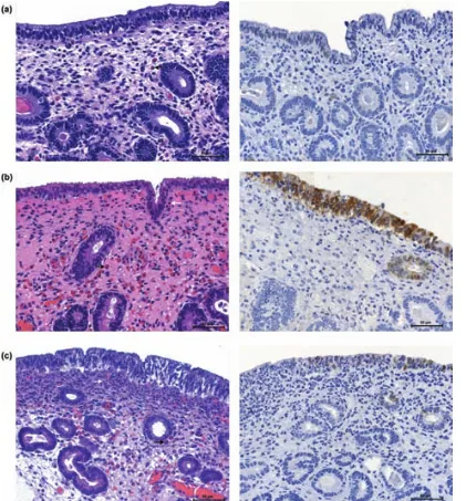 Fig. 1. Representative images showing sections of H/E-stained biopsies and COX-2 immunohistochemical labelling in jennies in oestrus (C), 6 h afterinsemination with frozen–thawed sperm but with no SP (−SP), and 6 h after insemination with frozen–thawed sperm but with SP (+SP).