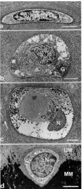 Figura 2: Fotografías de condrocitos con microscopio electrónico de transmisión, a partir de MM: Matriz mineralizada