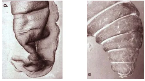 Figura 9 osteocondrales para implante en humanos vale la pena reducir cualquier posibilidad de error alteraciones en la morfología del espécimen que se desea estudiar, tal y como ocurrió con : Una mala técnica de fijación o errores desafortunados pueden pr