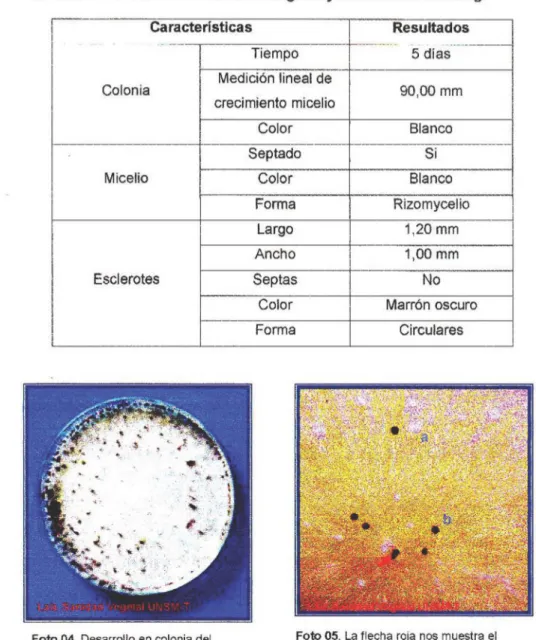 Cuadro Nº 14. Características morfológicas  y  biométricas del hongo  1  Caracterfstlcas  
