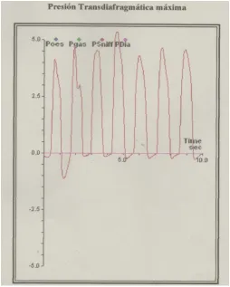Fig.5.- Sniff test  