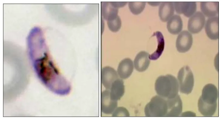 Figura 7: Gametocitos de Plasmodio falciparum 