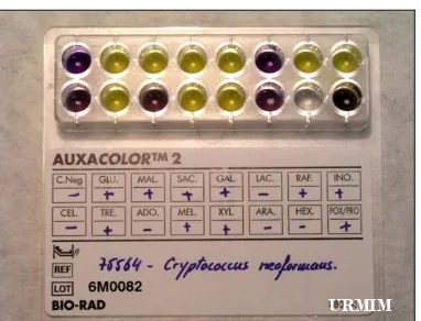 Figura 7: AUXACOLORTM2. Técnica comercial (BioRad®) para la identificación de levaduras, basada en el auxonograma, asimilación de azúcares