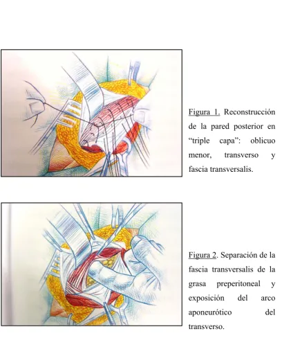 Figura 1. Reconstrucción 