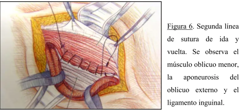 Figura 5. Primera línea de 