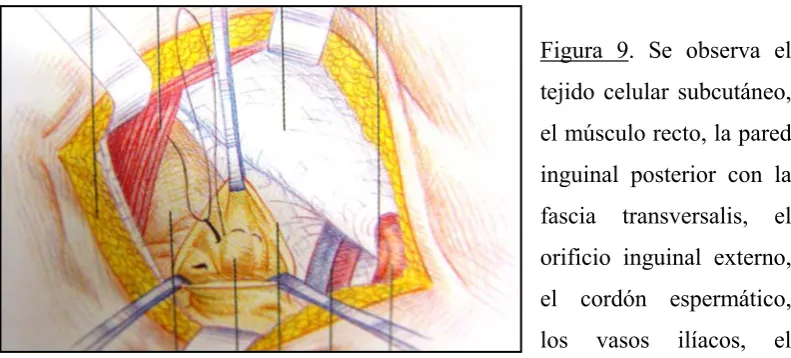 Figura 9. Se observa el 