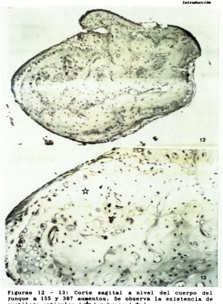 Figuras 12 - 13: Corte s a g i t a l a n i v e l d e l cuerpo del 