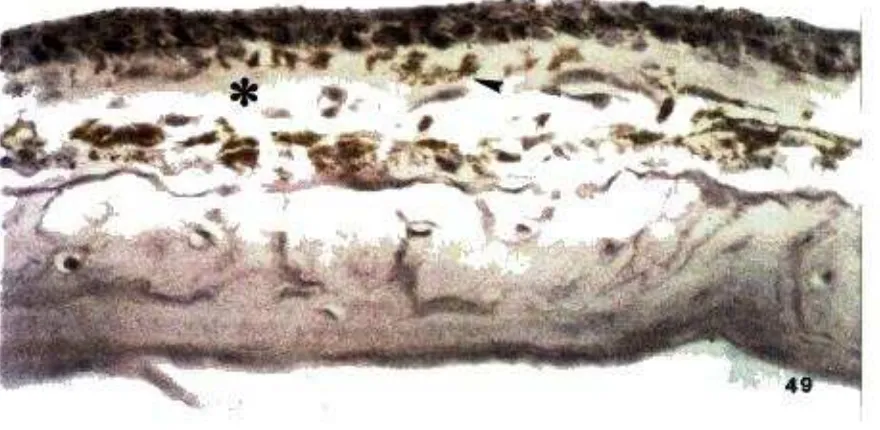 Figura 49:dermis amplia  P i e l y hueso de CAE normales ( x625 ) con una ( * ), melanina ( ) y epidermis con 
