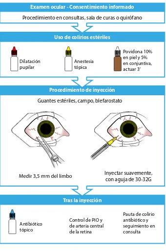 Figura 9. Algoritmo de la inyección intravítrea de la Sociedad Española de Retina y Vítreo