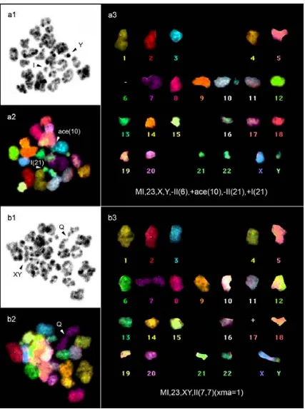 Figura 17. Espermatòcits I amb anomalies cromosòmiques meiòtiques analitzats amb la tècnica de M-FISH